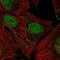Janus Kinase 2 antibody, NBP2-55362, Novus Biologicals, Immunocytochemistry image 