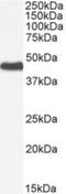 Patatin Like Phospholipase Domain Containing 3 antibody, NBP1-00227, Novus Biologicals, Western Blot image 