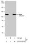 Actinin Alpha 3 (Gene/Pseudogene) antibody, GTX103216, GeneTex, Immunoprecipitation image 