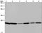 Rho GDP Dissociation Inhibitor Alpha antibody, LS-C405011, Lifespan Biosciences, Western Blot image 