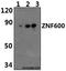 Zinc Finger Protein 600 antibody, A16463, Boster Biological Technology, Western Blot image 