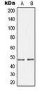 GHRHR antibody, LS-C352247, Lifespan Biosciences, Western Blot image 