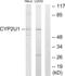 Cytochrome P450 Family 2 Subfamily U Member 1 antibody, abx013989, Abbexa, Western Blot image 