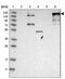 Ankyrin-2 antibody, NBP2-33863, Novus Biologicals, Western Blot image 