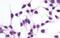 Adrenoceptor Beta 2 antibody, NLS2656, Novus Biologicals, Immunocytochemistry image 