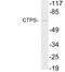 CTP Synthase 1 antibody, LS-C291691, Lifespan Biosciences, Western Blot image 