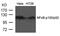 Nuclear Factor Kappa B Subunit 2 antibody, 79-265, ProSci, Western Blot image 