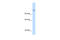Carbamoyl-Phosphate Synthase 1 antibody, 30-097, ProSci, Western Blot image 