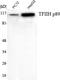 ERCC Excision Repair 3, TFIIH Core Complex Helicase Subunit antibody, M03103, Boster Biological Technology, Western Blot image 