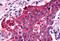 G Protein-Coupled Receptor 153 antibody, MBS244160, MyBioSource, Immunohistochemistry paraffin image 