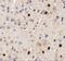 SPRY Domain Containing 3 antibody, A19152, Boster Biological Technology, Immunohistochemistry paraffin image 