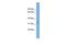 ADP Ribosylation Factor Like GTPase 13B antibody, GTX45703, GeneTex, Western Blot image 