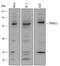 E3 ubiquitin-protein ligase TRIM32 antibody, AF6515, R&D Systems, Western Blot image 