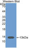 Caspase 6 antibody, LS-C314284, Lifespan Biosciences, Western Blot image 