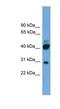 Proline Rich 5 antibody, NBP1-91481, Novus Biologicals, Western Blot image 