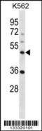 Notchless Homolog 1 antibody, 56-984, ProSci, Western Blot image 