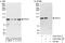 Vacuolar protein sorting-associated protein 11 homolog antibody, A303-527A, Bethyl Labs, Western Blot image 