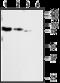 Purinergic Receptor P2X 2 antibody, GTX16789, GeneTex, Western Blot image 