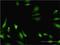 Cystathionine-Beta-Synthase antibody, H00000875-M02, Novus Biologicals, Immunocytochemistry image 