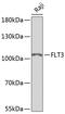 Fms Related Tyrosine Kinase 3 antibody, GTX33202, GeneTex, Western Blot image 