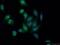Histone Deacetylase 5 antibody, 16166-1-AP, Proteintech Group, Immunofluorescence image 