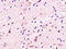Cholinergic Receptor Nicotinic Alpha 7 Subunit antibody, 251420, Abbiotec, Immunohistochemistry paraffin image 
