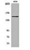 Ubiquitin Specific Peptidase 42 antibody, orb163137, Biorbyt, Western Blot image 