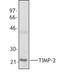 TIMP Metallopeptidase Inhibitor 2 antibody, LS-B1660, Lifespan Biosciences, Western Blot image 