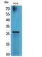 RNA Polymerase III Subunit G antibody, PA5-51120, Invitrogen Antibodies, Western Blot image 