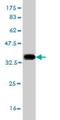 Solute Carrier Family 6 Member 19 antibody, H00340024-M01, Novus Biologicals, Western Blot image 