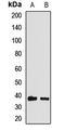 Homeobox A11 antibody, orb412147, Biorbyt, Western Blot image 