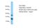 Chromosome 22 Open Reading Frame 39 antibody, A16496, Boster Biological Technology, Western Blot image 