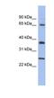 HORMA Domain Containing 2 antibody, NBP1-52868, Novus Biologicals, Western Blot image 