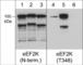 Eukaryotic Elongation Factor 2 Kinase antibody, EP4411, ECM Biosciences, Western Blot image 