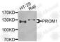 Prominin 1 antibody, A9915, ABclonal Technology, Western Blot image 