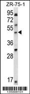 LIM Domain Binding 1 antibody, 58-052, ProSci, Western Blot image 