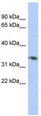 Homeobox D10 antibody, TA330143, Origene, Western Blot image 