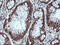 Myosin Binding Protein H antibody, M12390, Boster Biological Technology, Immunohistochemistry paraffin image 