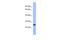 DR1 Associated Protein 1 antibody, A08536, Boster Biological Technology, Western Blot image 