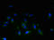 STEAP3 Metalloreductase antibody, LS-C377755, Lifespan Biosciences, Immunofluorescence image 