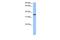 Heterogeneous Nuclear Ribonucleoprotein A2/B1 antibody, GTX47243, GeneTex, Western Blot image 