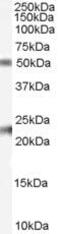 Fibulin 5 antibody, PA5-18568, Invitrogen Antibodies, Western Blot image 