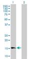 Glycosylphosphatidylinositol Specific Phospholipase D1 antibody, H00002822-B01P, Novus Biologicals, Western Blot image 