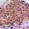 Ribosomal Protein S6 Kinase B1 antibody, LS-C354084, Lifespan Biosciences, Immunohistochemistry paraffin image 