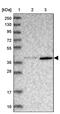 Actin Binding LIM Protein 1 antibody, PA5-58608, Invitrogen Antibodies, Western Blot image 