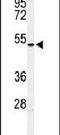 Homeobox A3 antibody, PA5-26887, Invitrogen Antibodies, Western Blot image 