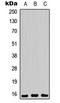 Proliferation And Apoptosis Adaptor Protein 15 antibody, LS-C368454, Lifespan Biosciences, Western Blot image 