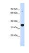 Ras Homolog Family Member T1 antibody, NBP1-59609, Novus Biologicals, Western Blot image 