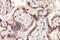 Teratocarcinoma-Derived Growth Factor 1 antibody, NBP1-68841, Novus Biologicals, Immunohistochemistry paraffin image 