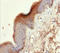 Keratin 6A antibody, LS-C675970, Lifespan Biosciences, Immunohistochemistry paraffin image 